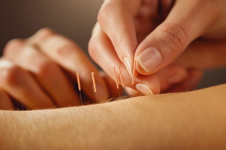 A Complete Guide to TCM Acupuncture Singapore: Benefits, Process, and What to Expect